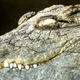 Image for article titled Krokodil: Russia's Designer Drug That Will Eat Your Flesh